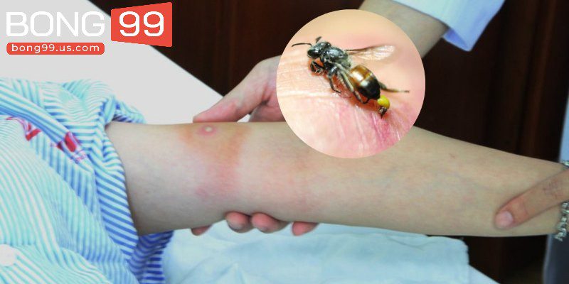 Mơ bị ong đốt đánh con gì khi làm vườn đánh 23 - 90